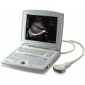 Mensch mit digitalem Laptop-Ultraschallscanner (XT-FL037)